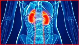 tumor de feocromocitoma 2