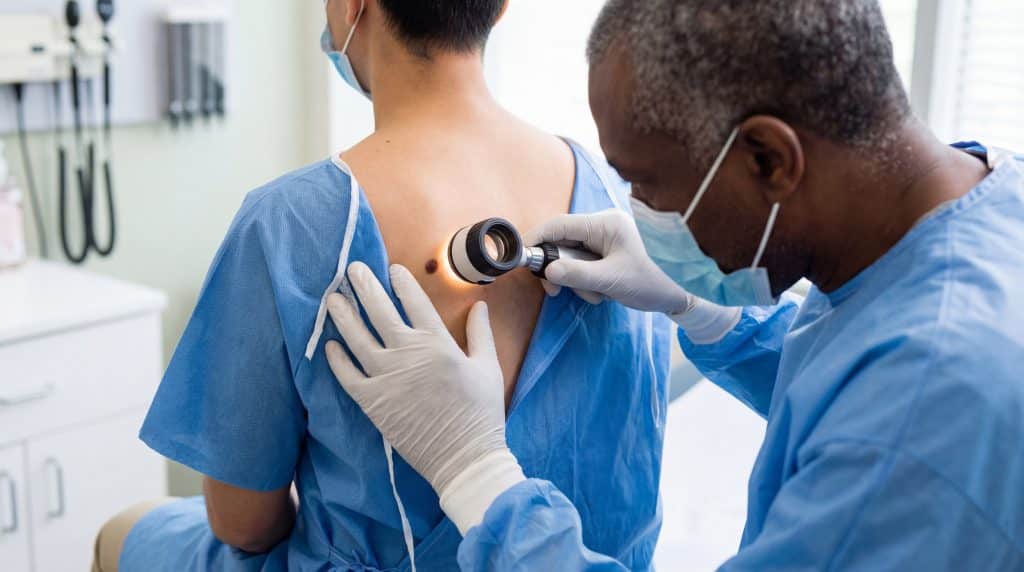 Médico negro com avental cirúrgico azul e luvas brancas examina pinta nas costas de paciente branco ao investigar câncer de pele