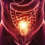 Esquistossomose: Foto gerada com inteligência artificial mostrando órgãos do abdômen