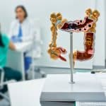 Modelo anatômico do intestino grosso em destaque sobre a mesa durante consulta médica, pois geralmente a Doença de Crohn é comum na região final do intestino delgado e no início do intestino grosso.