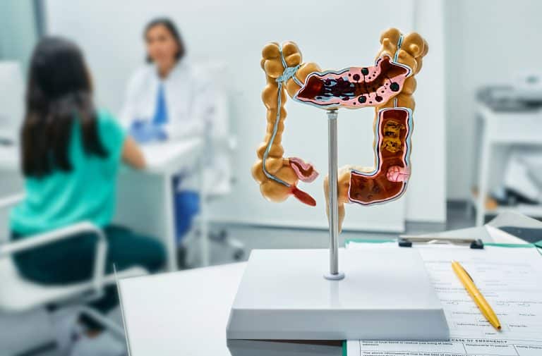 Modelo anatômico do intestino grosso em destaque sobre a mesa durante consulta médica, pois geralmente a Doença de Crohn é comum na região final do intestino delgado e no início do intestino grosso.