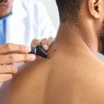Médico examinando pinta nas costas de paciente com dermatoscópio, representando a avaliação e prevenção do câncer de pele.
