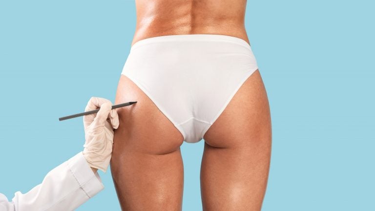 Profissional de saúde avaliando a região dos glúteos de uma paciente durante consulta estética, ilustrando o uso de PMMA em procedimentos de preenchimento corporal.