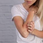 Mulher coçando o braço com irritação e vermelhidão na pele, representando cuidados e possíveis reações relacionadas ao uso de repelente.